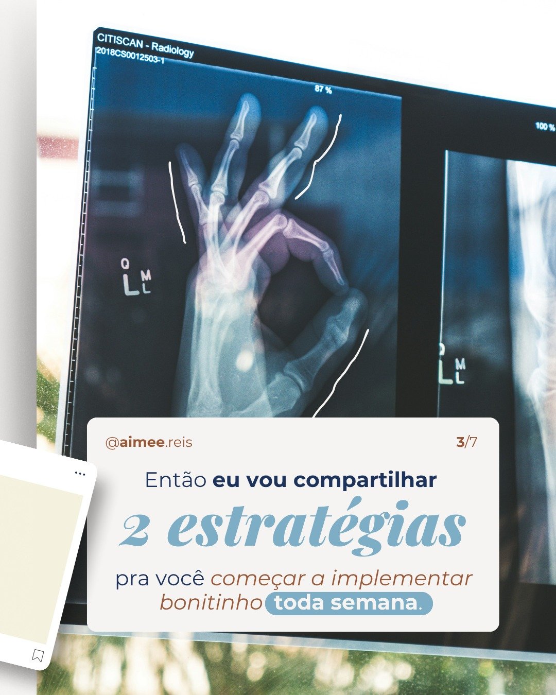 [CARROSSEL #04_3] Estratégias INJUSTAS para agendar pacientes